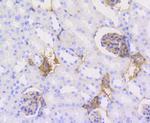 Caldesmon Antibody in Immunohistochemistry (Paraffin) (IHC (P))