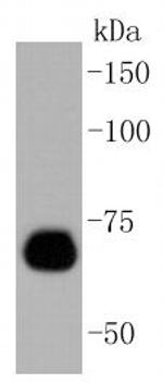 Caldesmon Antibody in Western Blot (WB)