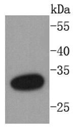 DARPP-32 Recombinant Rabbit Monoclonal Antibody (SU0329)