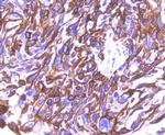 Cytokeratin 8 Recombinant Rabbit Monoclonal Antibody (SU0338)