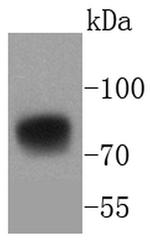 5T4 Recombinant Rabbit Monoclonal Antibody (SU34-05)