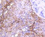 CD90 (Thy1) Antibody in Immunohistochemistry (Paraffin) (IHC (P))