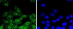 Phospho-RSK1 (Thr359, Ser363) Recombinant Rabbit Monoclonal Antibody (SU03-65)
