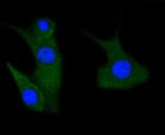 Phospho-PAK1/2/3 (Ser144, Ser141, Ser139) Recombinant Rabbit Monoclonal Antibody (SU03-70)