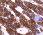 Calreticulin Recombinant Rabbit Monoclonal Antibody (SU37-03)