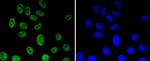 H3K56ac Recombinant Rabbit Monoclonal Antibody (SU30-10)