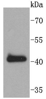 SOX18 Recombinant Rabbit Monoclonal Antibody (ST43-02)