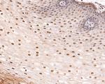 Phospho-p53 (Thr55) Antibody in Immunohistochemistry (Paraffin) (IHC (P))