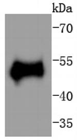 Phospho-p53 (Thr55) Antibody in Western Blot (WB)