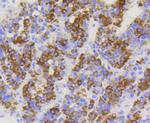 TOMM20 Antibody in Immunohistochemistry (Paraffin) (IHC (P))