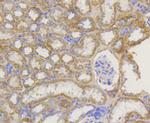 TOMM20 Antibody in Immunohistochemistry (Paraffin) (IHC (P))