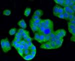 LC3A Antibody in Immunocytochemistry (ICC/IF)