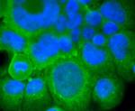 mGluR5 Antibody in Immunocytochemistry (ICC/IF)