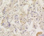 beta Arrestin 1 Antibody in Immunohistochemistry (Paraffin) (IHC (P))
