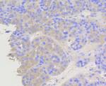 beta Arrestin 1 Antibody in Immunohistochemistry (Paraffin) (IHC (P))