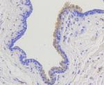 beta Arrestin 1 Antibody in Immunohistochemistry (Paraffin) (IHC (P))