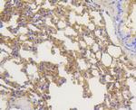 beta Arrestin 1 Antibody in Immunohistochemistry (Paraffin) (IHC (P))
