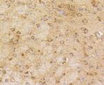 beta Arrestin 1 Antibody in Immunohistochemistry (Paraffin) (IHC (P))