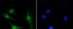 PKC beta-2 Recombinant Rabbit Monoclonal Antibody (ST48-06)