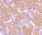 Phospho-MEK1 (Ser218, Ser222) Antibody in Immunohistochemistry (Paraffin) (IHC (P))