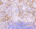 Human IgG4 Recombinant Rabbit Monoclonal Antibody (ST05-12)