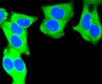 Cytokeratin 7 Antibody in Immunocytochemistry (ICC/IF)