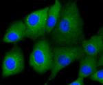 Cytokeratin 7 Antibody in Immunocytochemistry (ICC/IF)