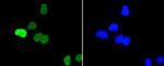 Phospho-c-Myc (Ser62) Recombinant Rabbit Monoclonal Antibody (ST49-08)