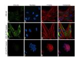 Collagen I Recombinant Rabbit Monoclonal Antibody (ST58-04)