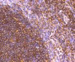 GRK2 Antibody in Immunohistochemistry (Paraffin) (IHC (P))