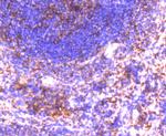 GRK2 Recombinant Rabbit Monoclonal Antibody (ST05-60)