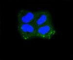 Cytokeratin 10 Recombinant Rabbit Monoclonal Antibody (ST05-43)