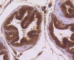 Musashi-2 Antibody in Immunohistochemistry (Paraffin) (IHC (P))