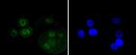 p73 Antibody in Immunocytochemistry (ICC/IF)