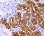 p73 Antibody in Immunohistochemistry (Paraffin) (IHC (P))