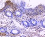 p73 Antibody in Immunohistochemistry (Paraffin) (IHC (P))
