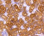 p73 Antibody in Immunohistochemistry (Paraffin) (IHC (P))