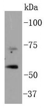 p73 Antibody in Western Blot (WB)