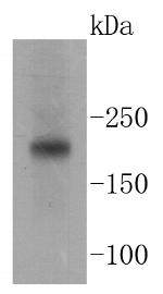 TSC2 Antibody in Western Blot (WB)