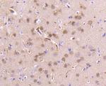PEBP1 Antibody in Immunohistochemistry (Paraffin) (IHC (P))