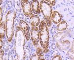 UBC9 Antibody in Immunohistochemistry (Paraffin) (IHC (P))