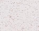 Phospho-ATF2 (Thr71) Antibody in Immunohistochemistry (Paraffin) (IHC (P))