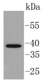 ISL1 Antibody in Western Blot (WB)