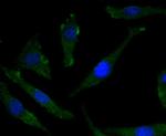 Phospho-TrkB (Tyr817) Recombinant Rabbit Monoclonal Antibody (SC0556)