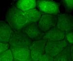 Phospho-EGFR (Tyr1173) Antibody in Immunocytochemistry (ICC/IF)