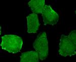 Phospho-EGFR (Tyr1173) Antibody in Immunocytochemistry (ICC/IF)