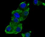 Phospho-EGFR (Tyr1173) Antibody in Immunocytochemistry (ICC/IF)