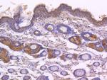 Phospho-EGFR (Tyr1173) Antibody in Immunohistochemistry (Paraffin) (IHC (P))