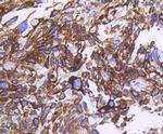 Cytokeratin 14 Antibody in Immunohistochemistry (Paraffin) (IHC (P))