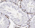 WT1 Recombinant Rabbit Monoclonal Antibody (SC06-41)